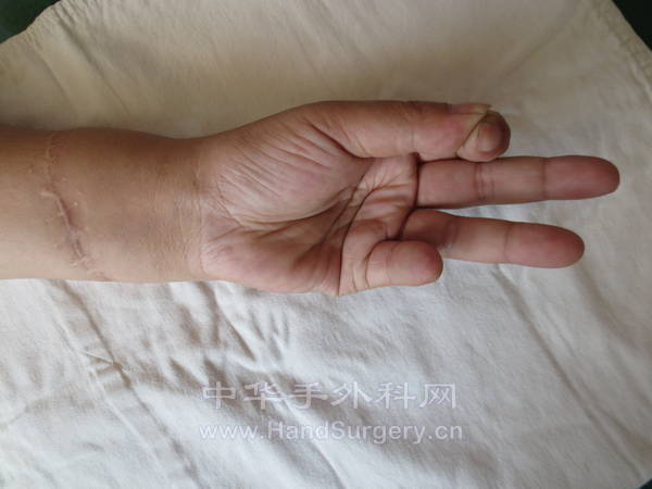 对指功能