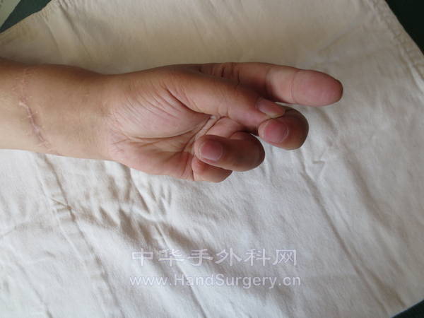对指功能