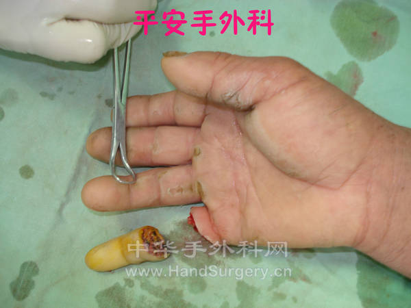 DSC03863_meitu_3.jpg