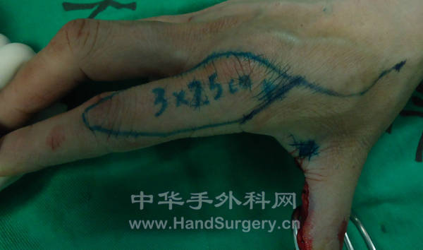 DSC00093_meitu_5.jpg