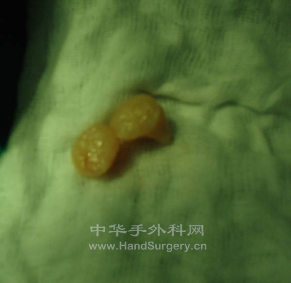 DSC00303_meitu_5.jpg