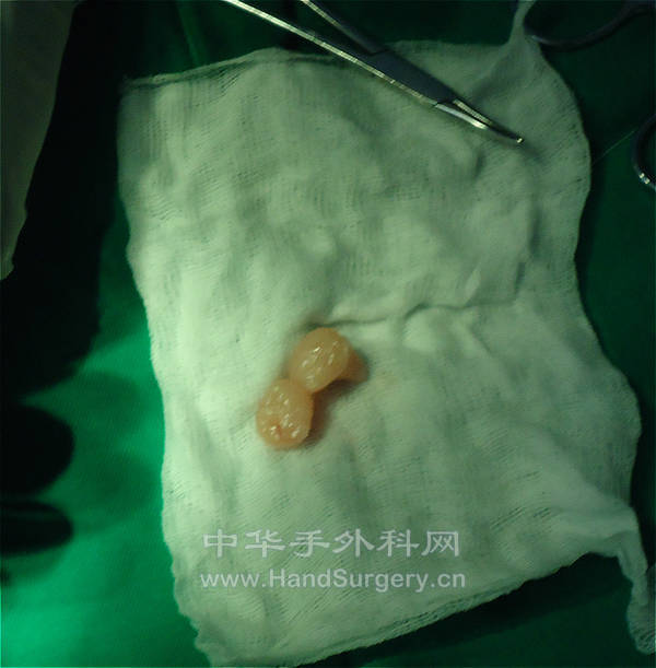 DSC00301_meitu_4.jpg