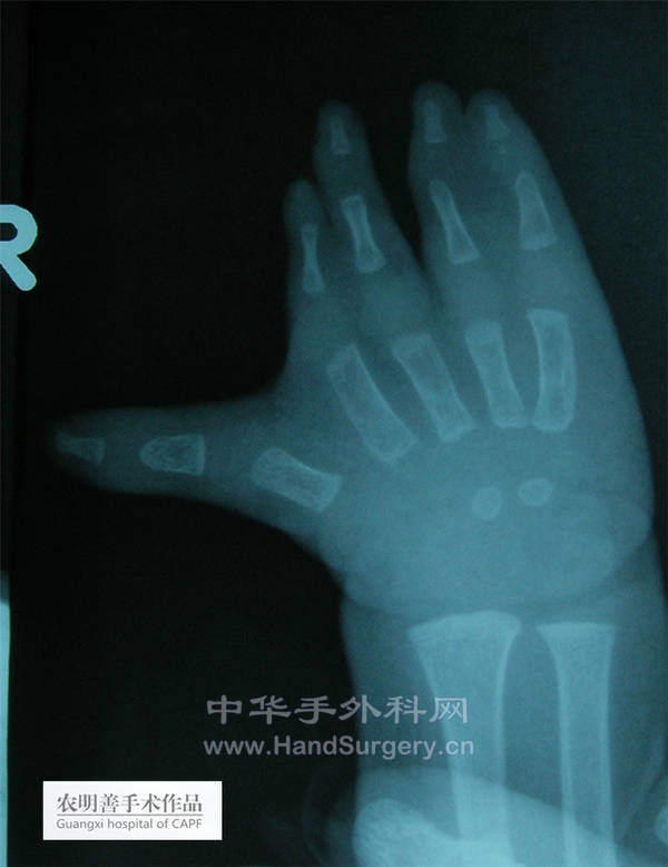 09.jpg