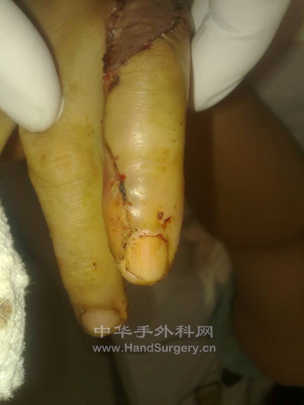 20120903255.jpg
