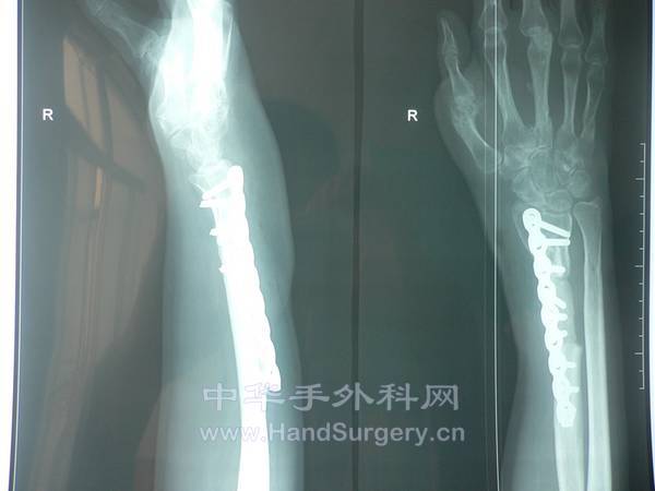 nEO_IMG_杨53.jpg