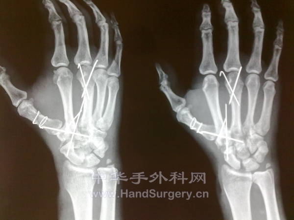 201305101224.jpg