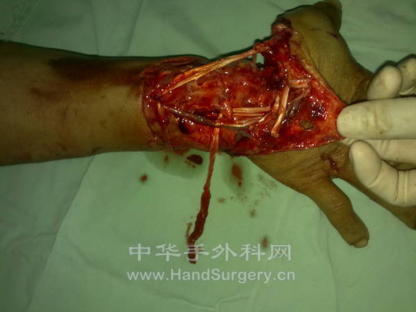 20130407702.jpg