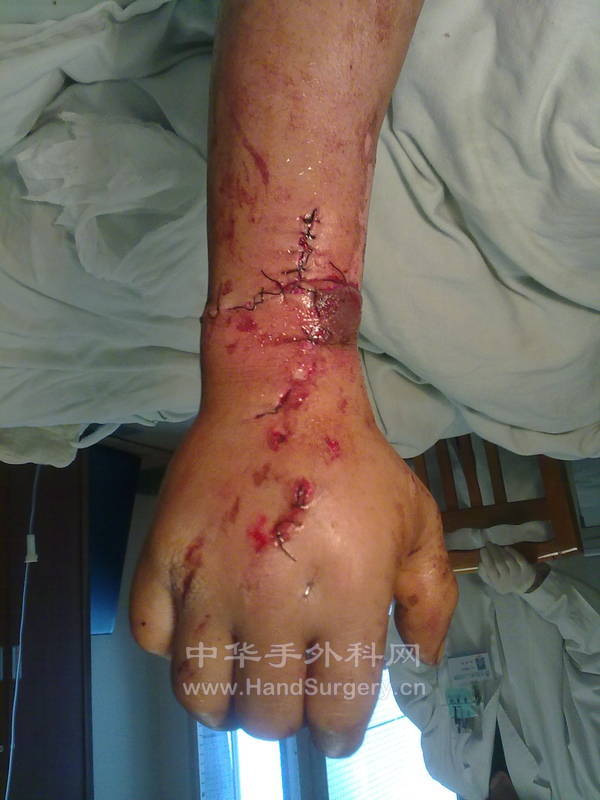 20130410744.jpg