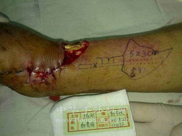 20130426996.jpg