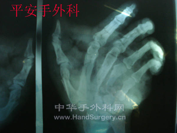 DSC03920_meitu_1.jpg