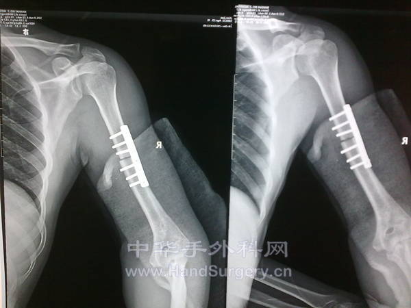 20111225413.jpg