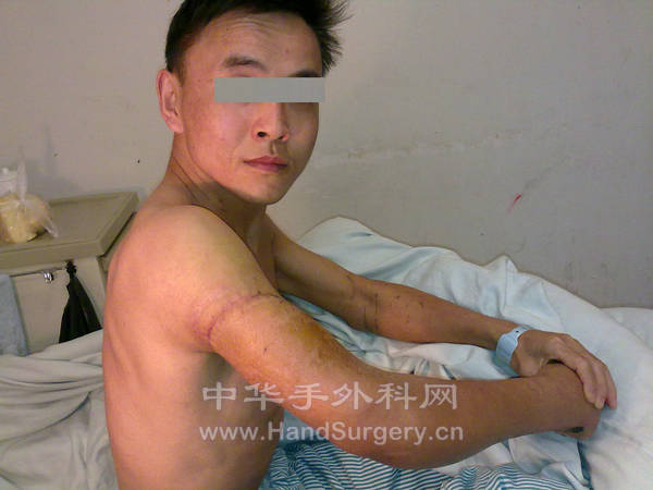 20120114536.jpg