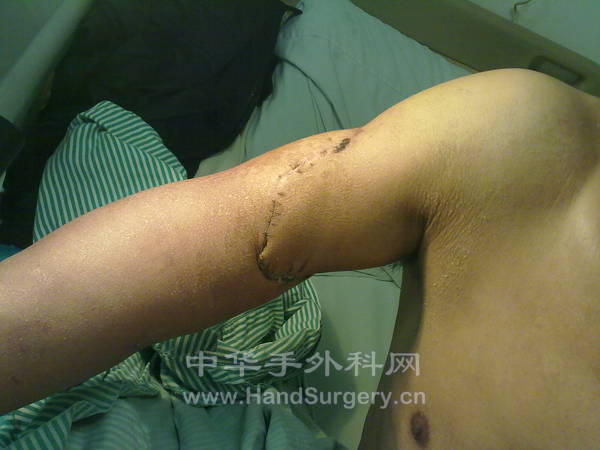 20120114538.jpg