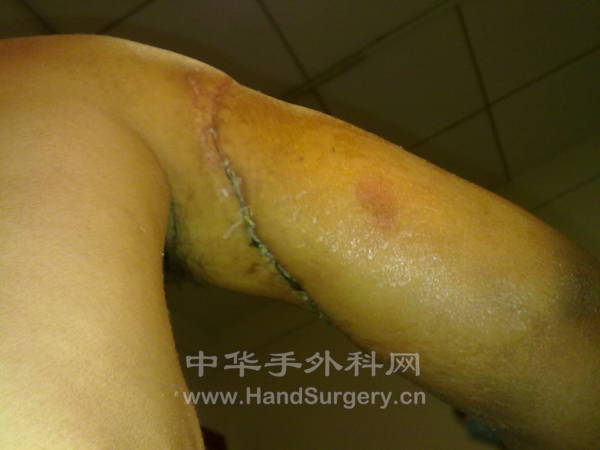 20120114539.jpg