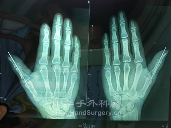 20130516_084329.jpg