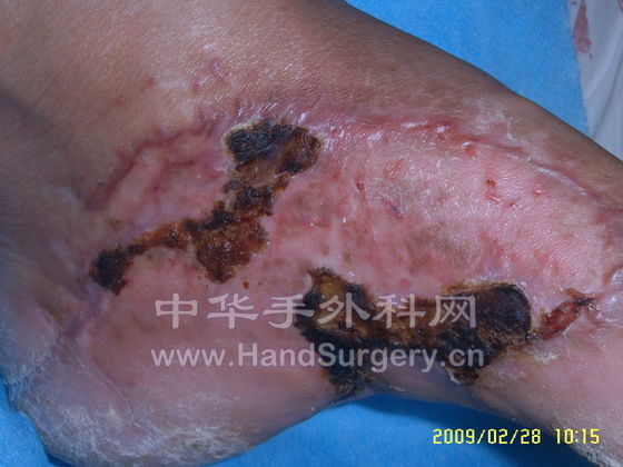 SUC51520.JPG