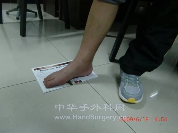 术后8周