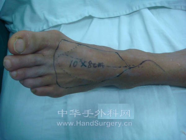 20081125-3.JPG