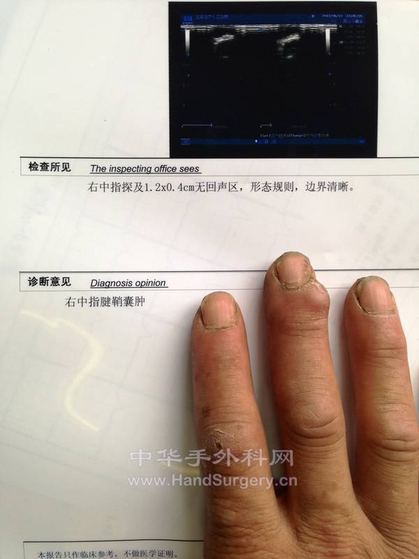 术前3.jpg