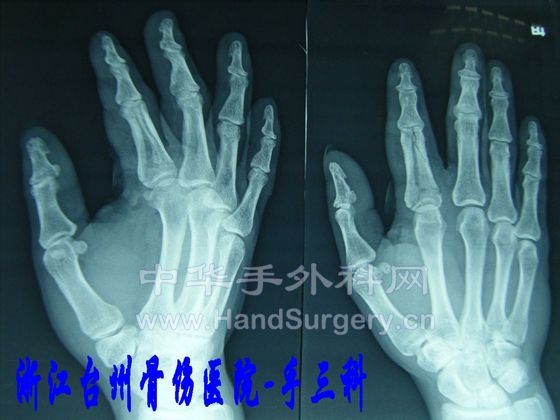 DSCF5286.JPG