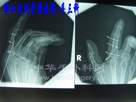DSCF5285.JPG