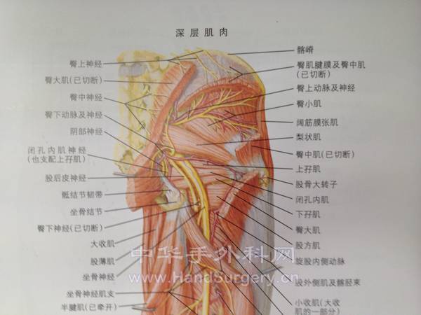 髋关节的解剖