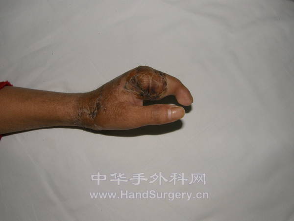 修复术后复查情况