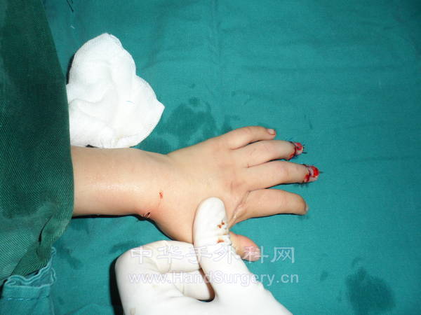 7床  任芷晴  13060882 (5).JPG