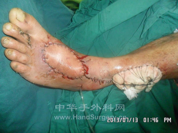 书中照片忘照了，见谅
