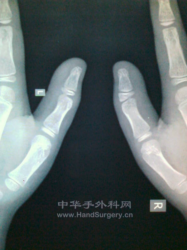 片子1.jpg