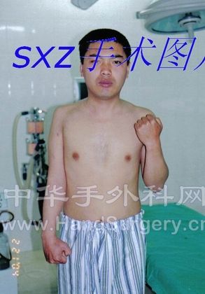 手术前