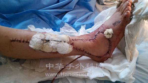 IMG_20130725_081630.jpg