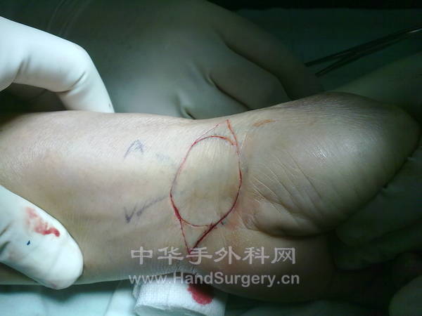 20130418835.jpg