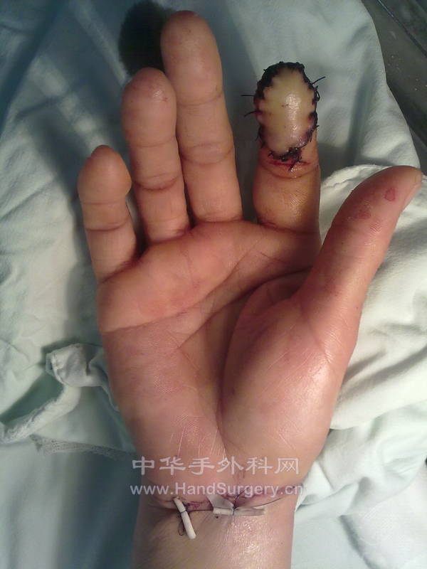 20130325617.jpg