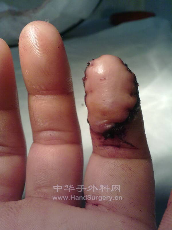 20130403674.jpg