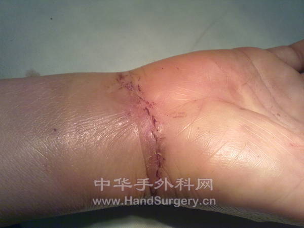 20130403675.jpg