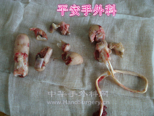 DSC01033_meitu_1.jpg