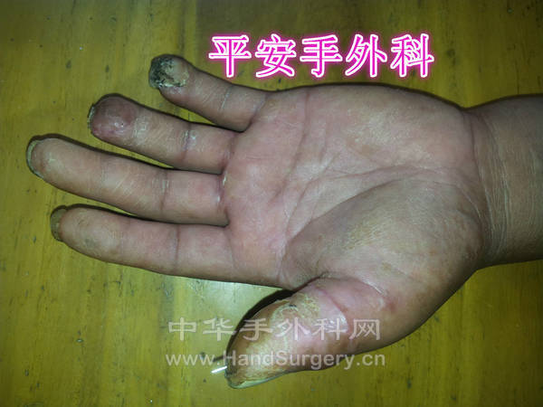 20130624_094335_meitu_5.jpg