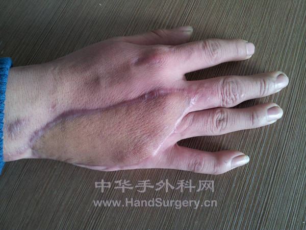 20111213_102739_副本.jpg