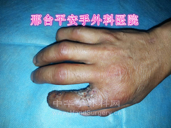 20130730_083528_meitu_3.jpg