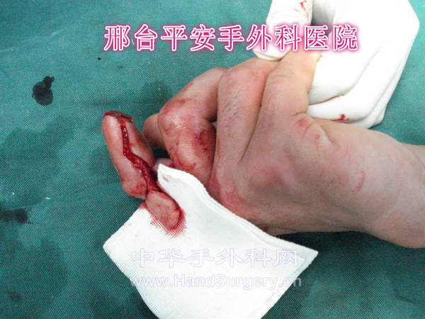 DSC04020_meitu_9.jpg