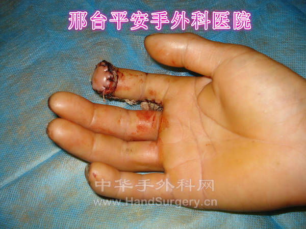 DSC04037_meitu_16.jpg