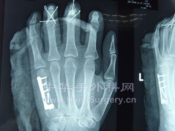 SNV35341.JPG