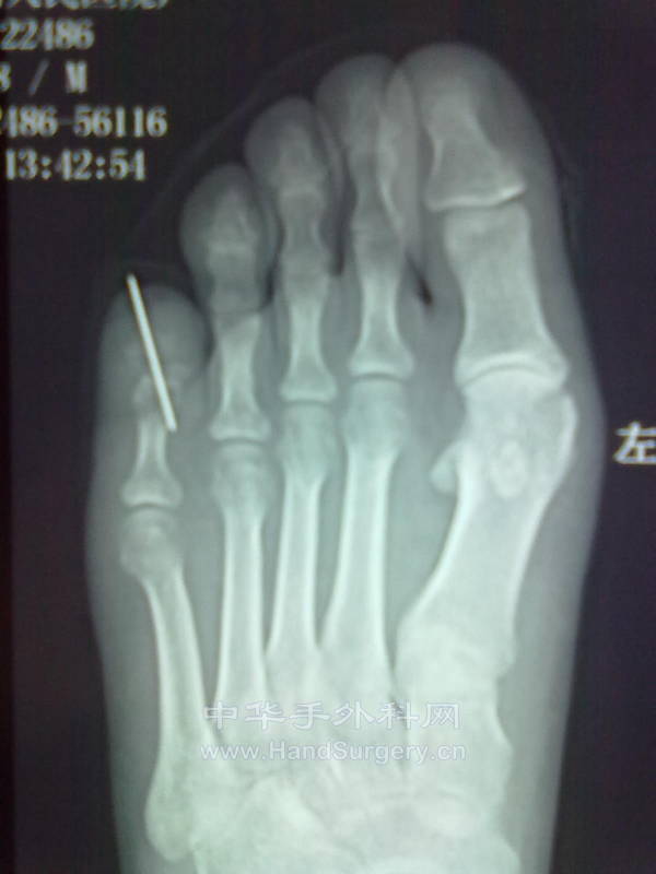 20121005696.jpg