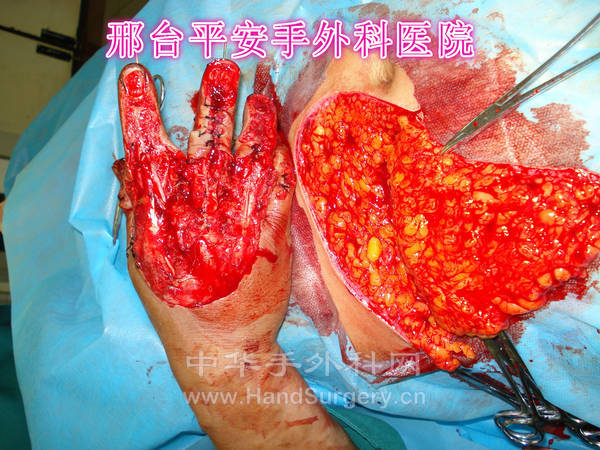 DSC03975_meitu_3.jpg