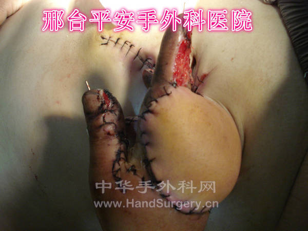 DSC03996_meitu_9.jpg