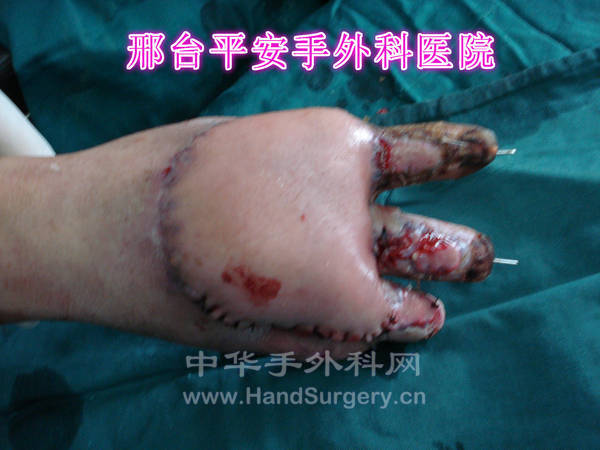 DSC04036_meitu_17.jpg