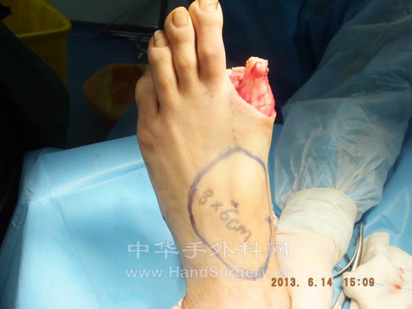 DSCF2171.JPG