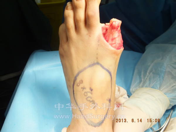 DSCF2172.JPG