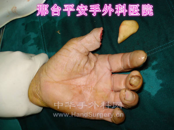 DSC04222_meitu_1.jpg